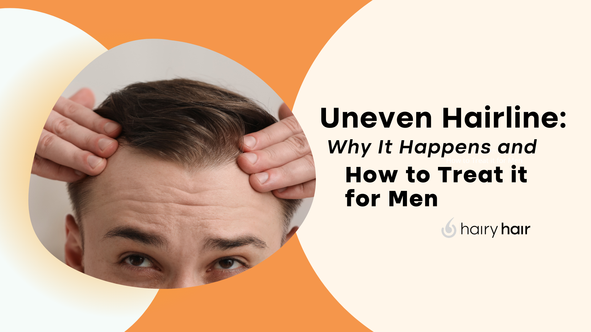 Uneven Hairline: Why it Happens and How to Treat it for Men